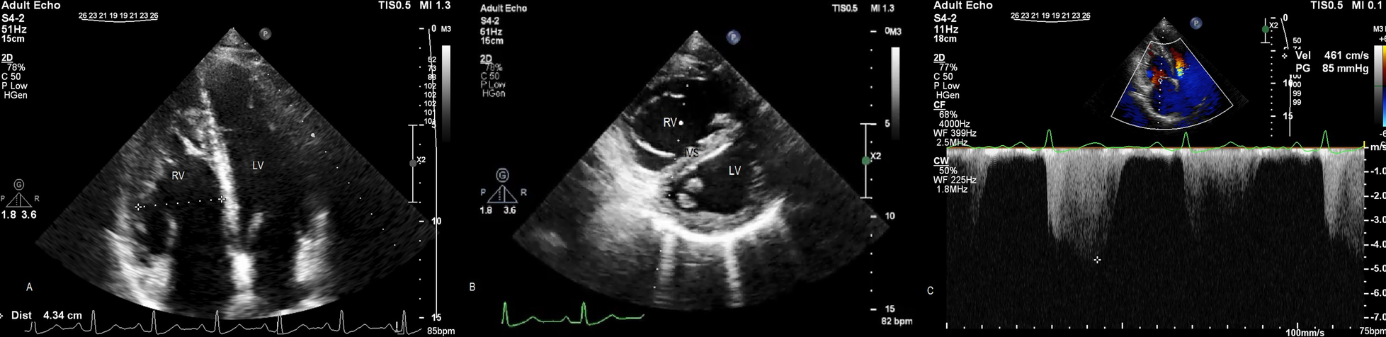 Fig. 2