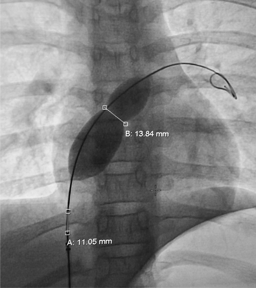 Fig. 3