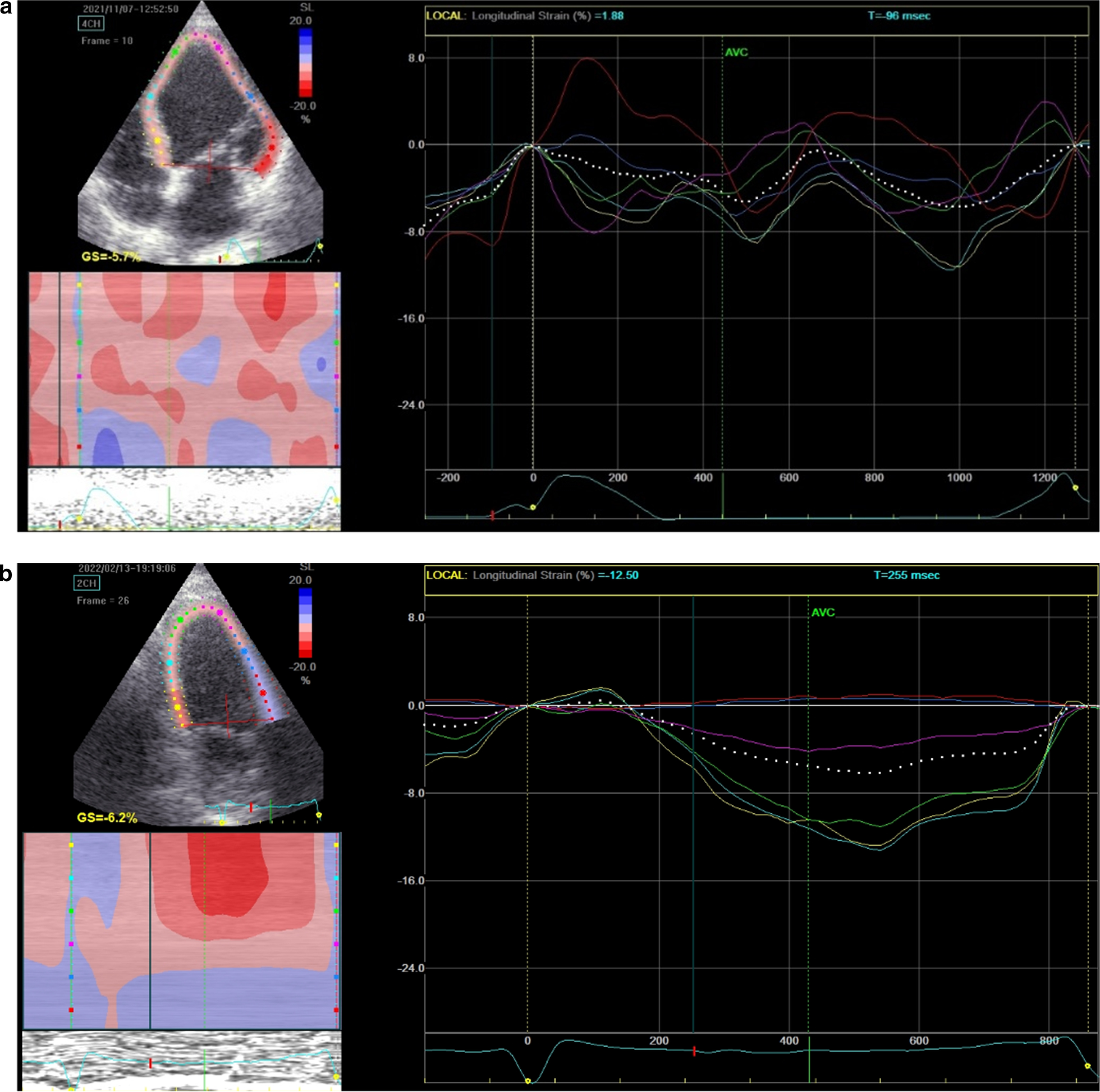 Fig. 4