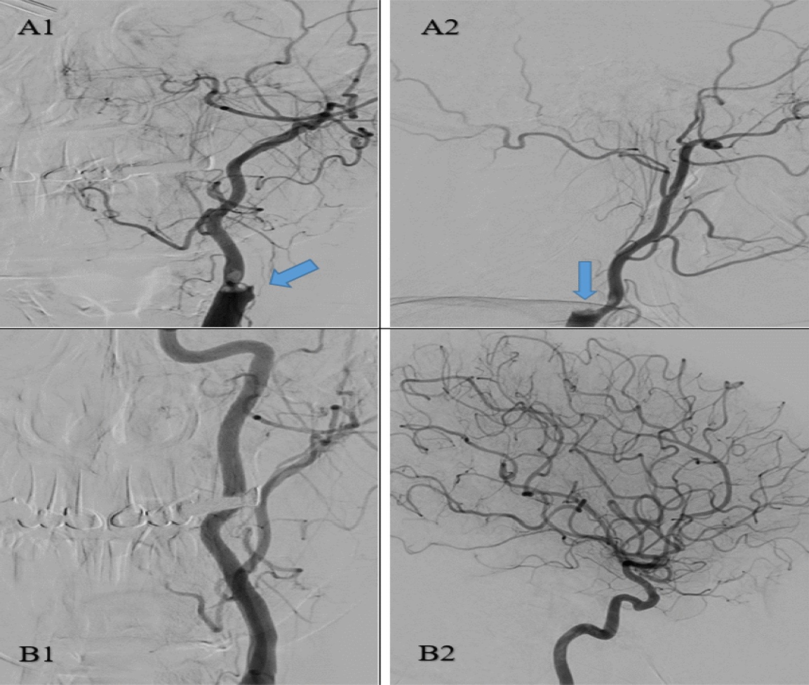 Fig. 4