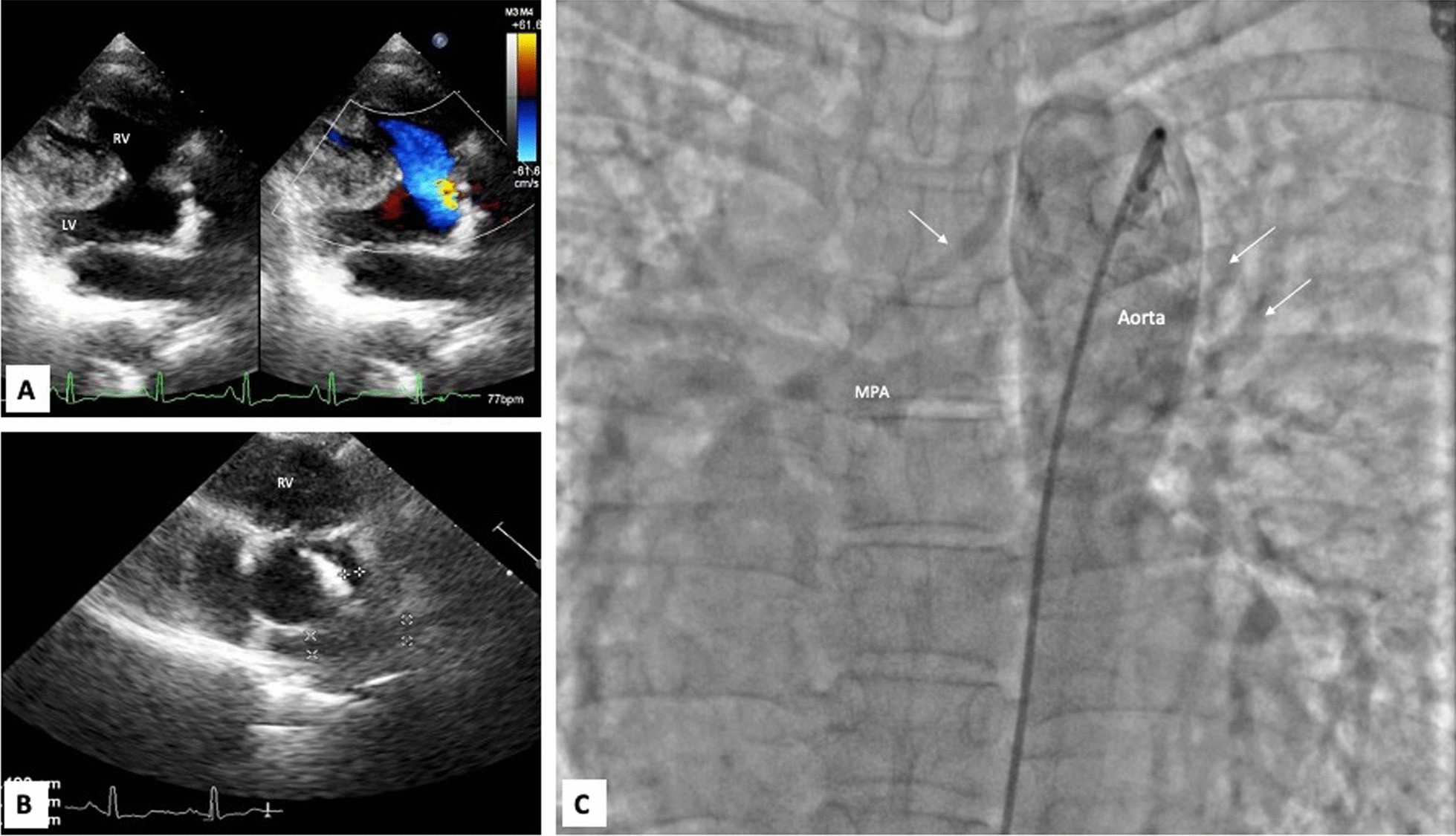 Fig. 2