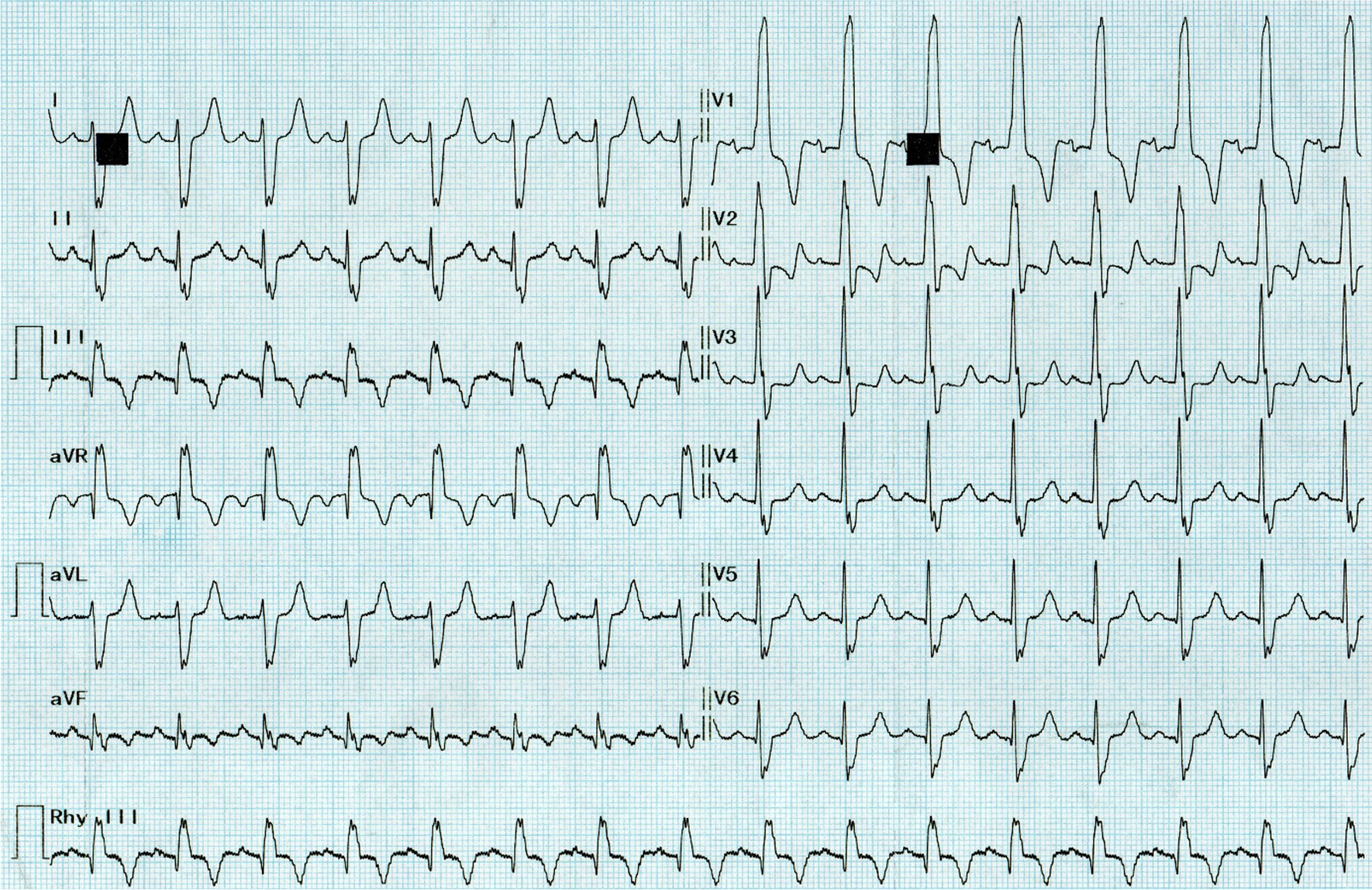 Fig. 1