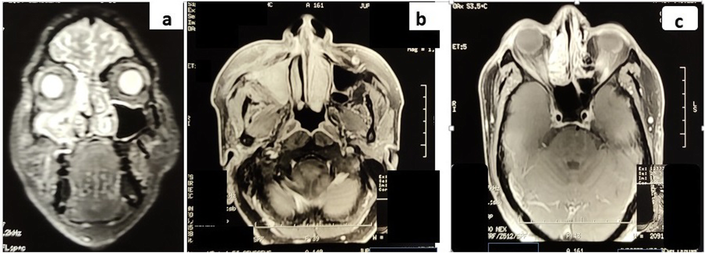 Fig. 4