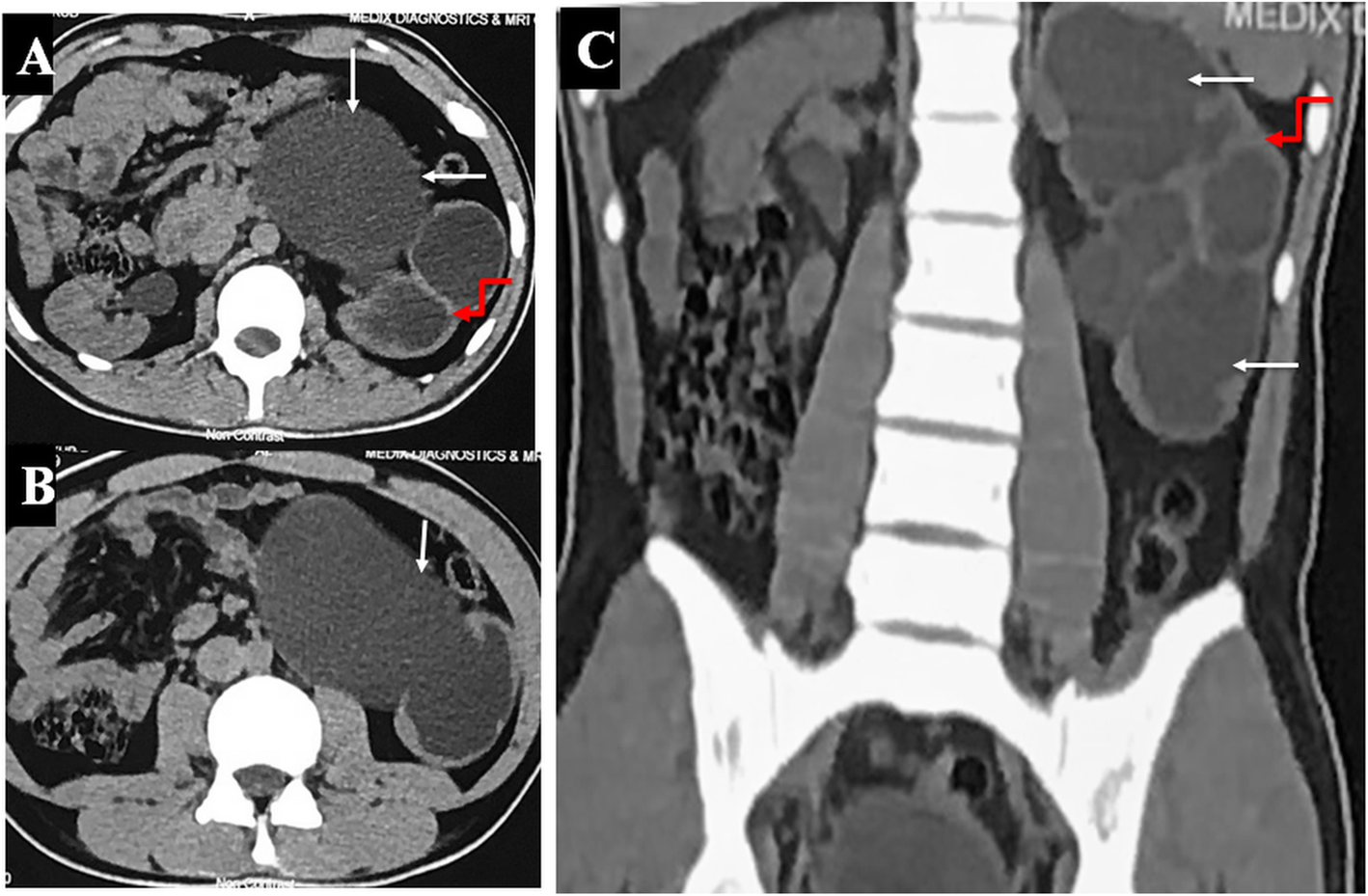 Fig. 1