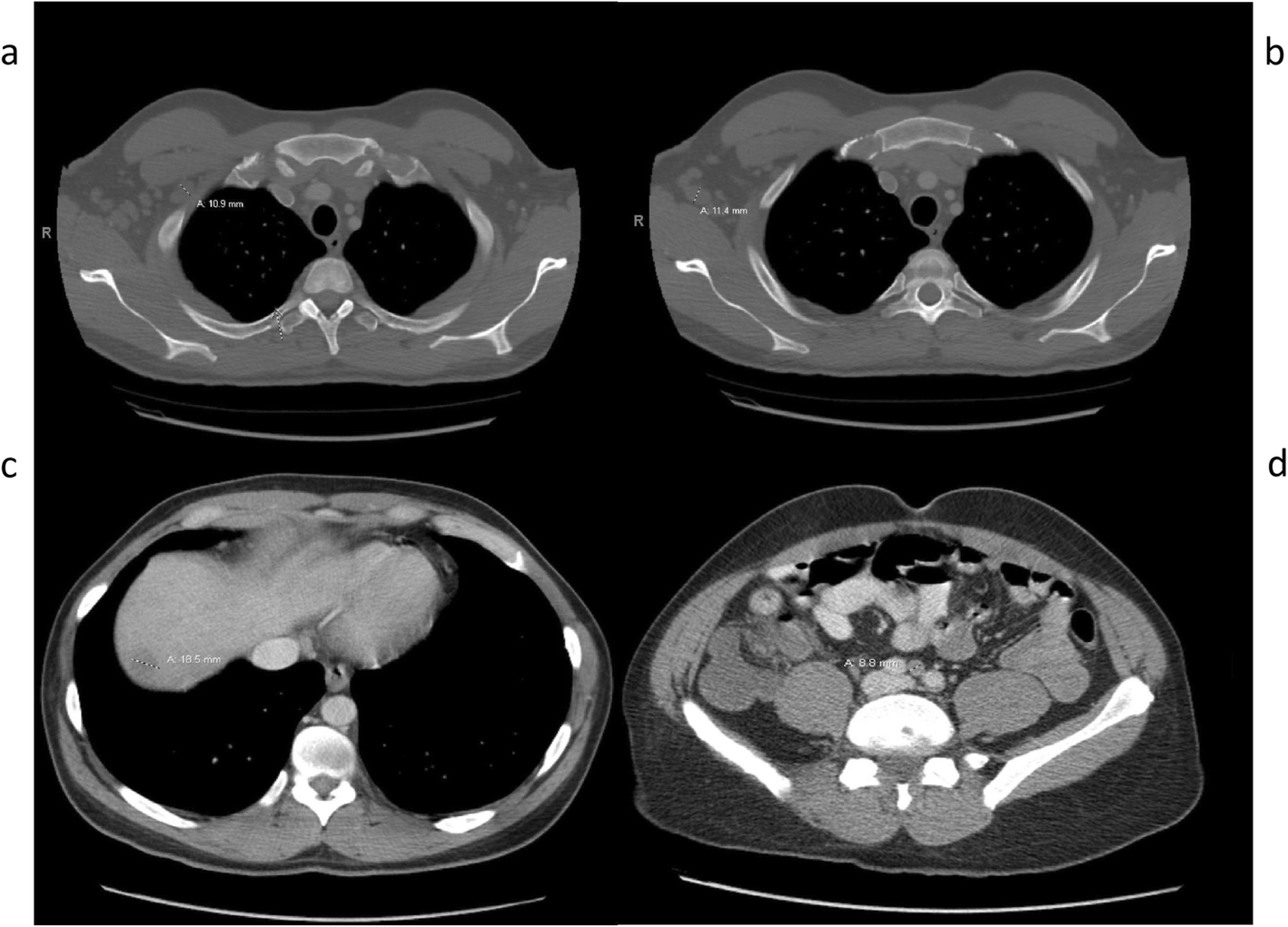 Fig. 2