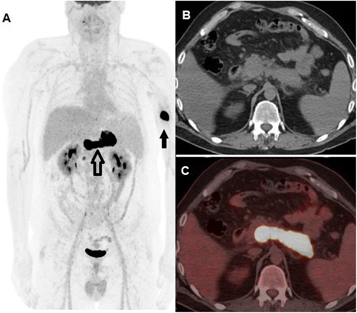 Fig. 1