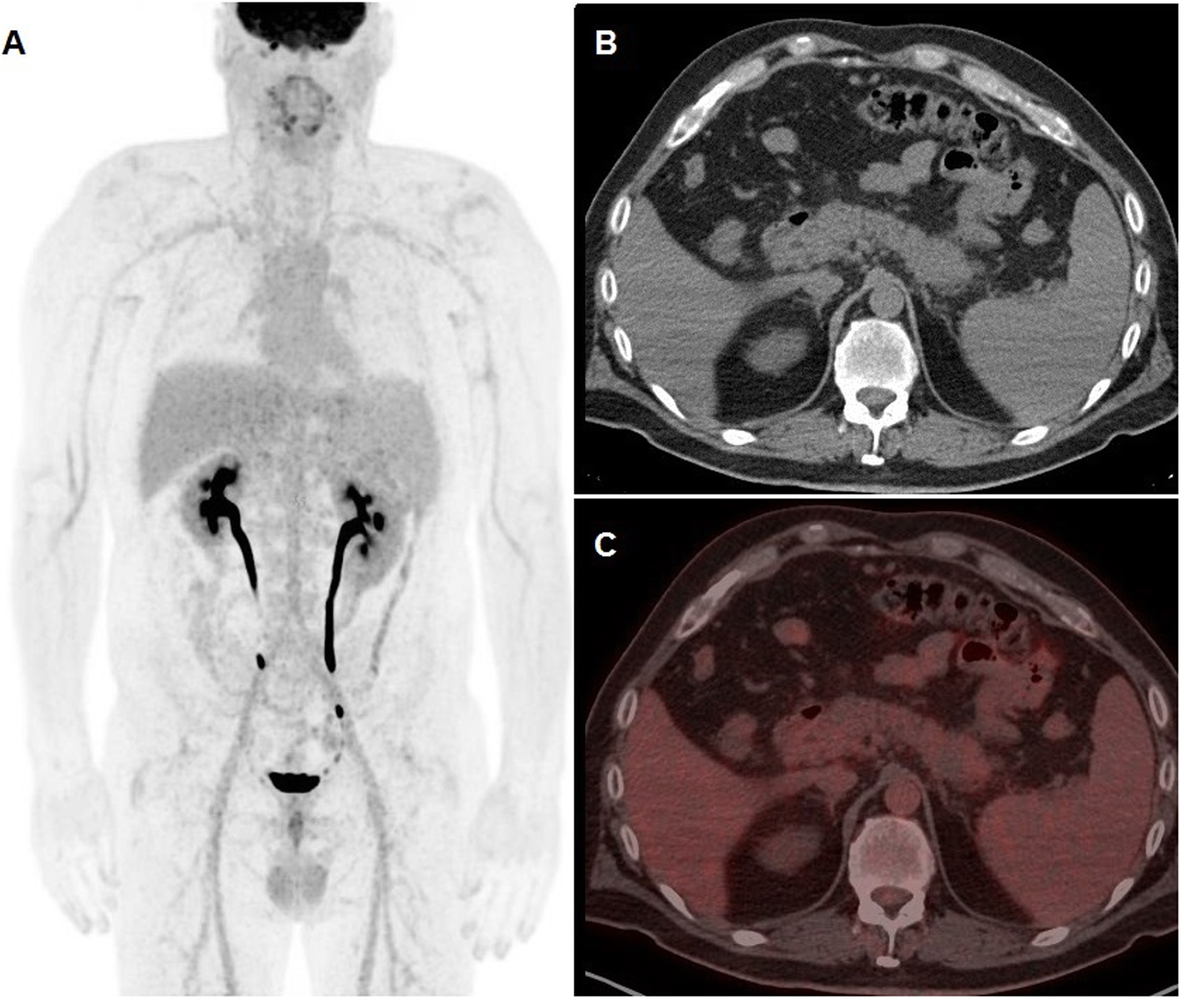 Fig. 2