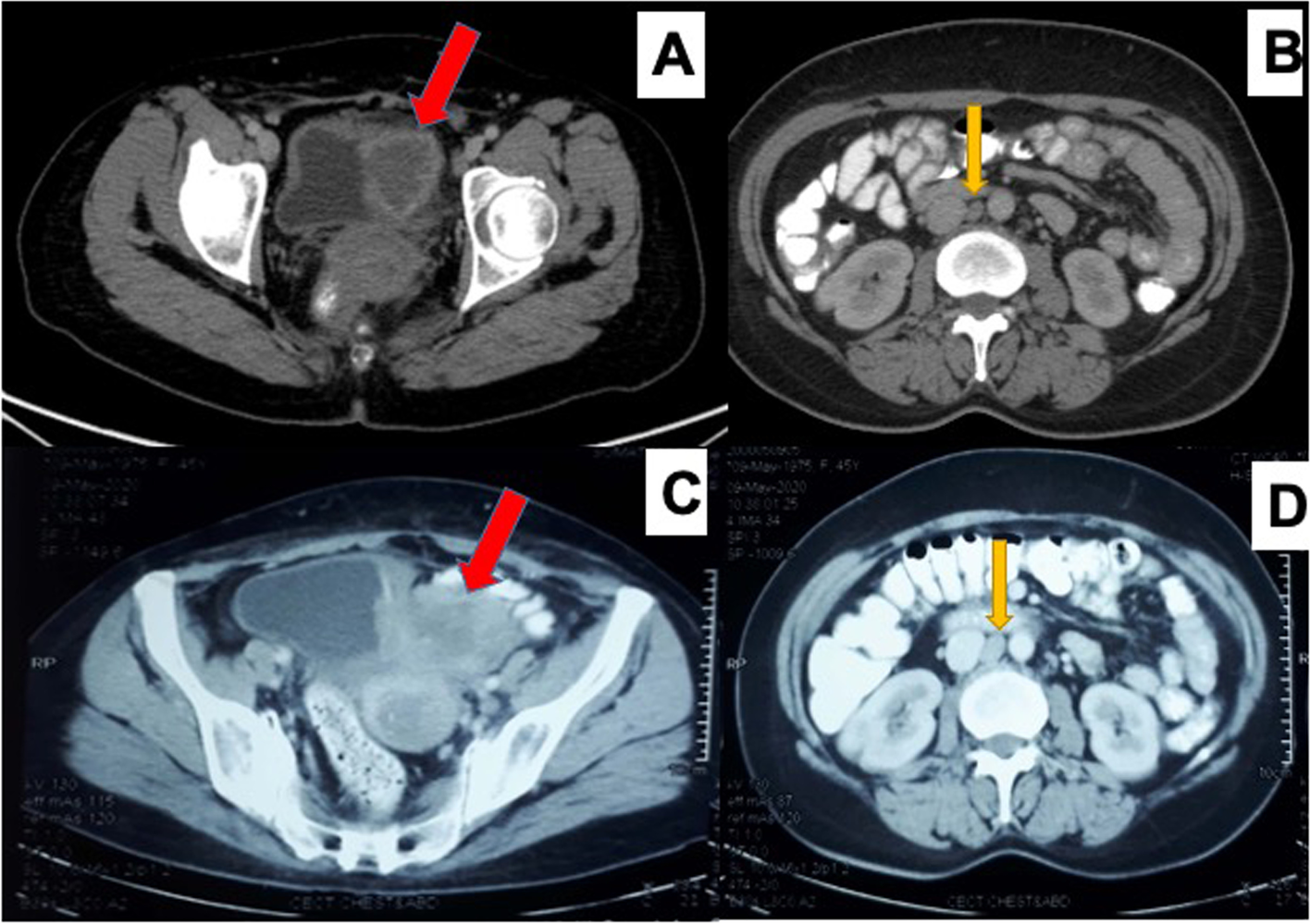 Fig. 1