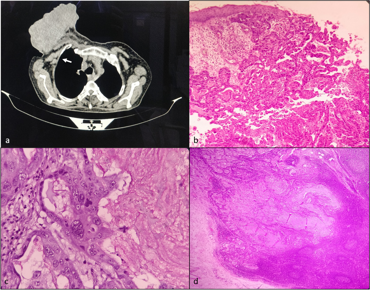 Fig. 1