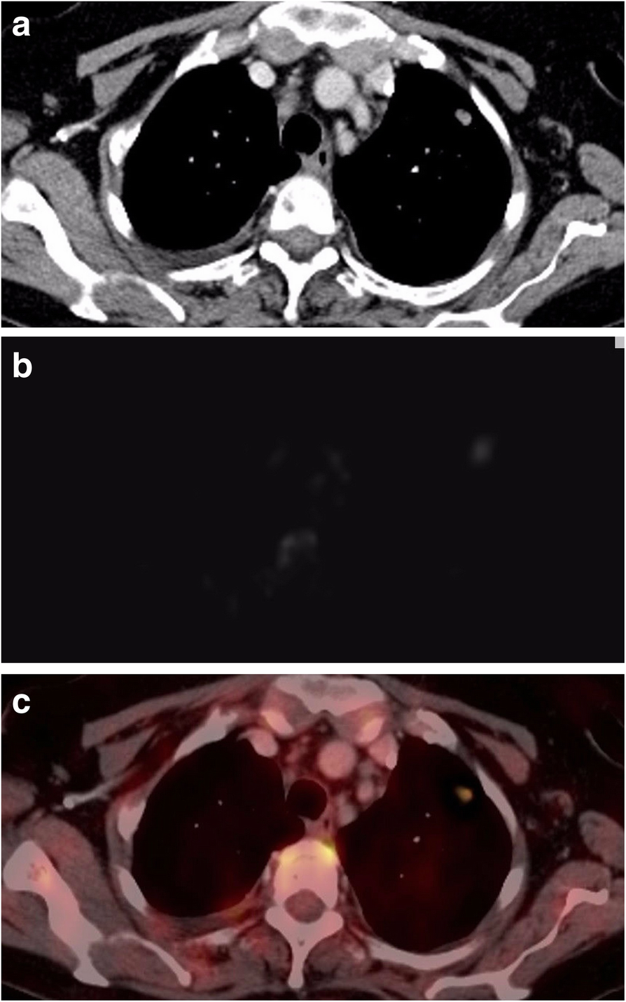 Fig. 5