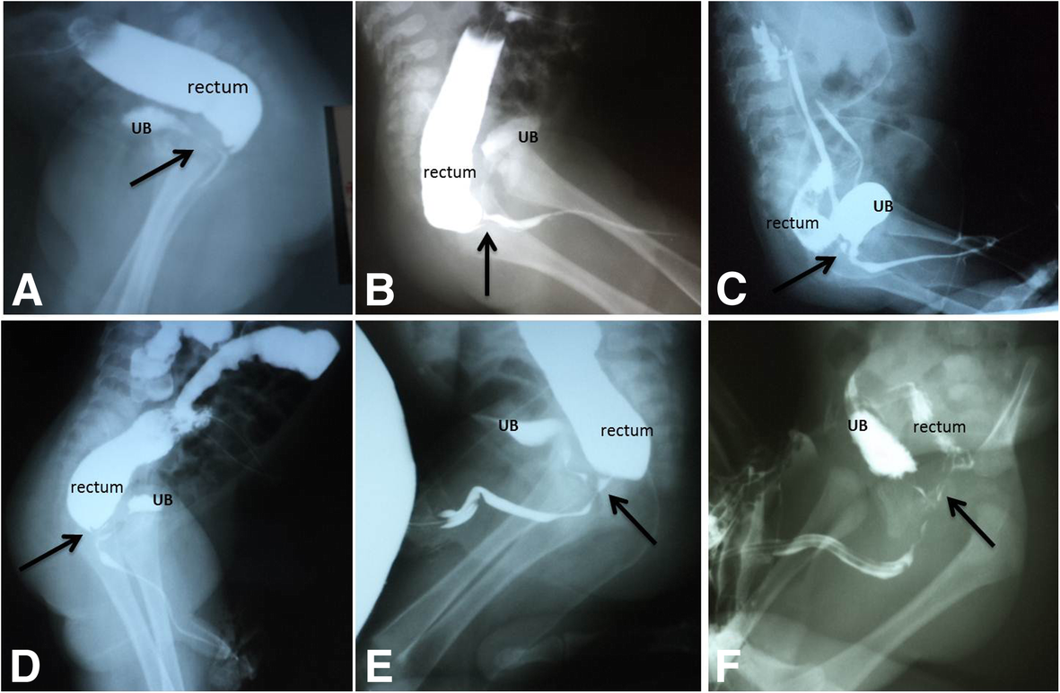 Fig. 12