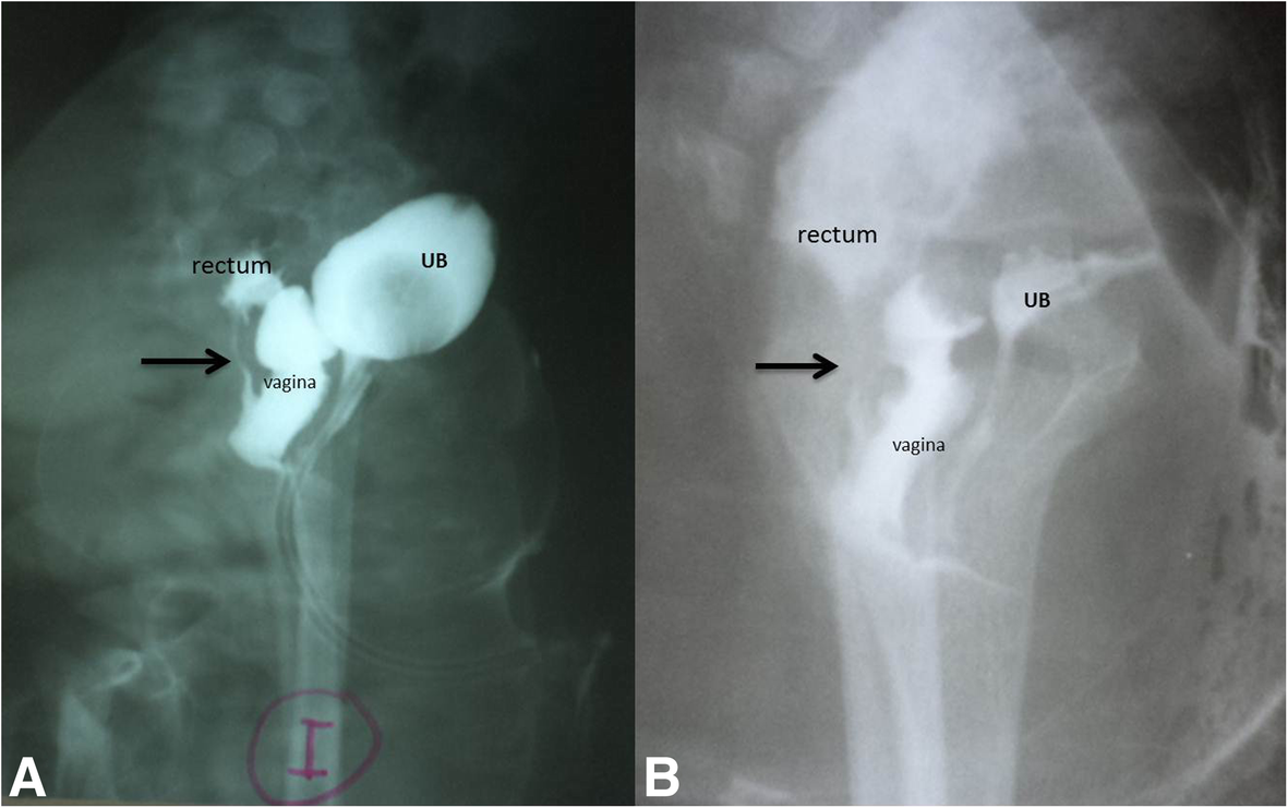 Fig. 14