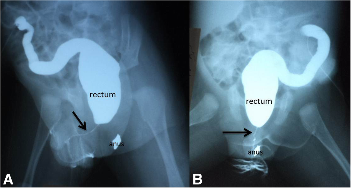 Fig. 15