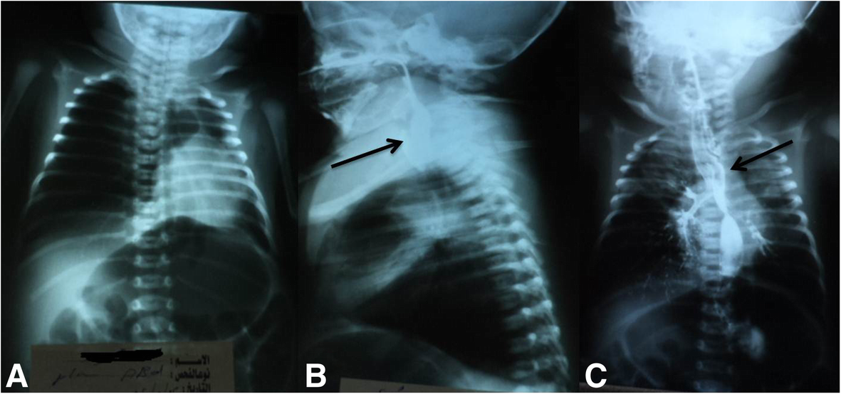 Fig. 5