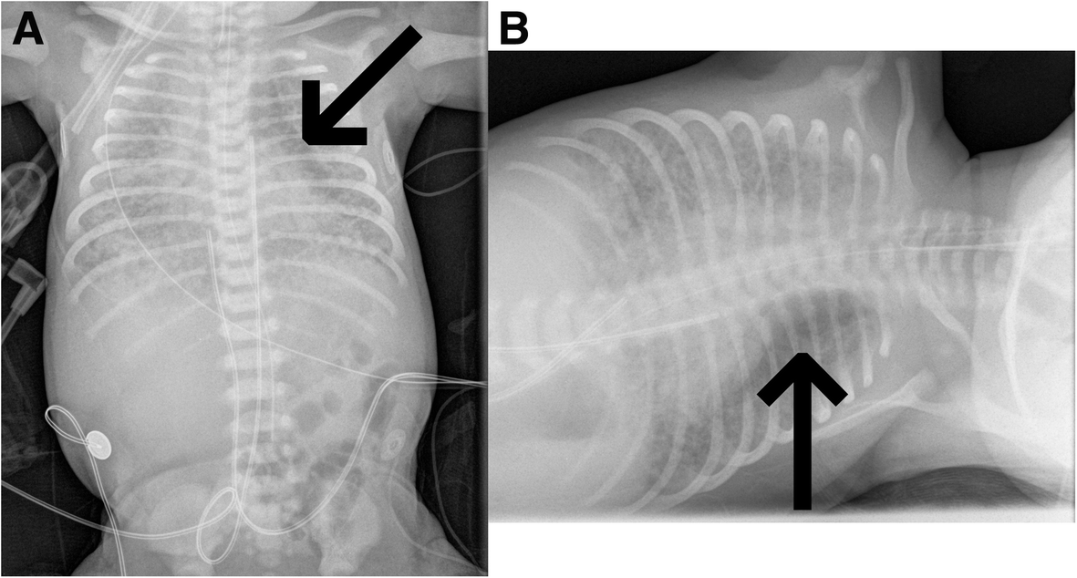 Fig. 10