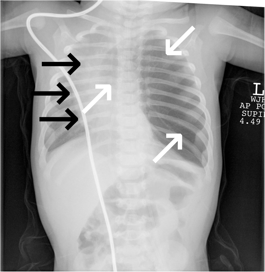 Fig. 13