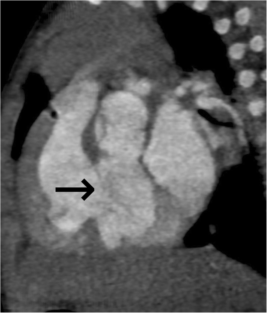 Fig. 18