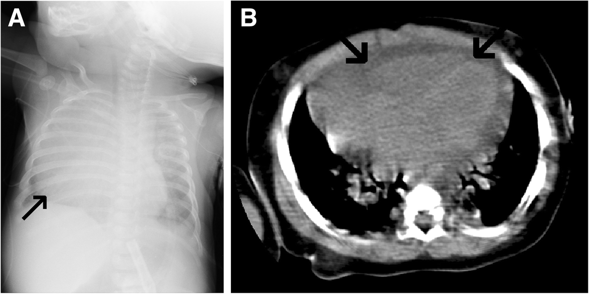 Fig. 19