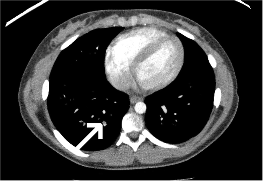 Fig. 21