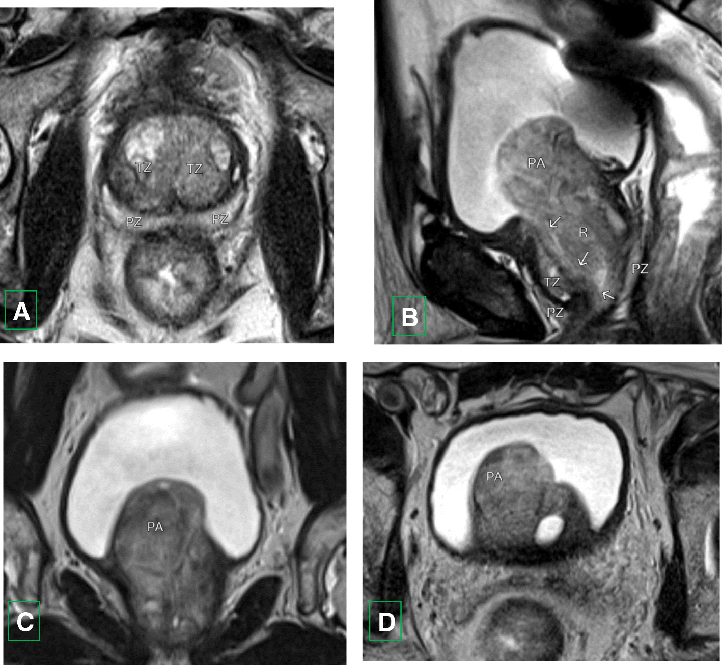 Fig. 7