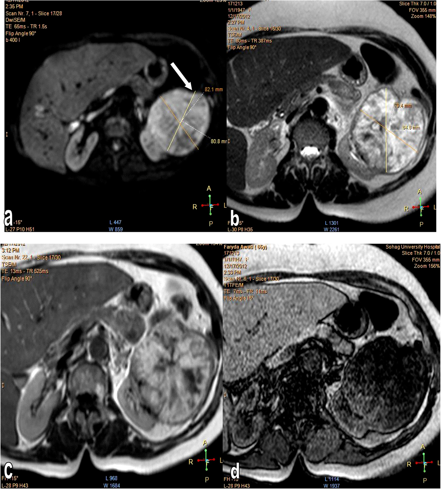 Fig. 1