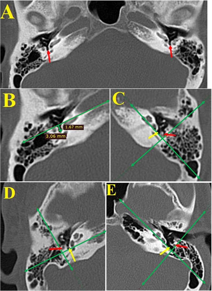 Fig. 4