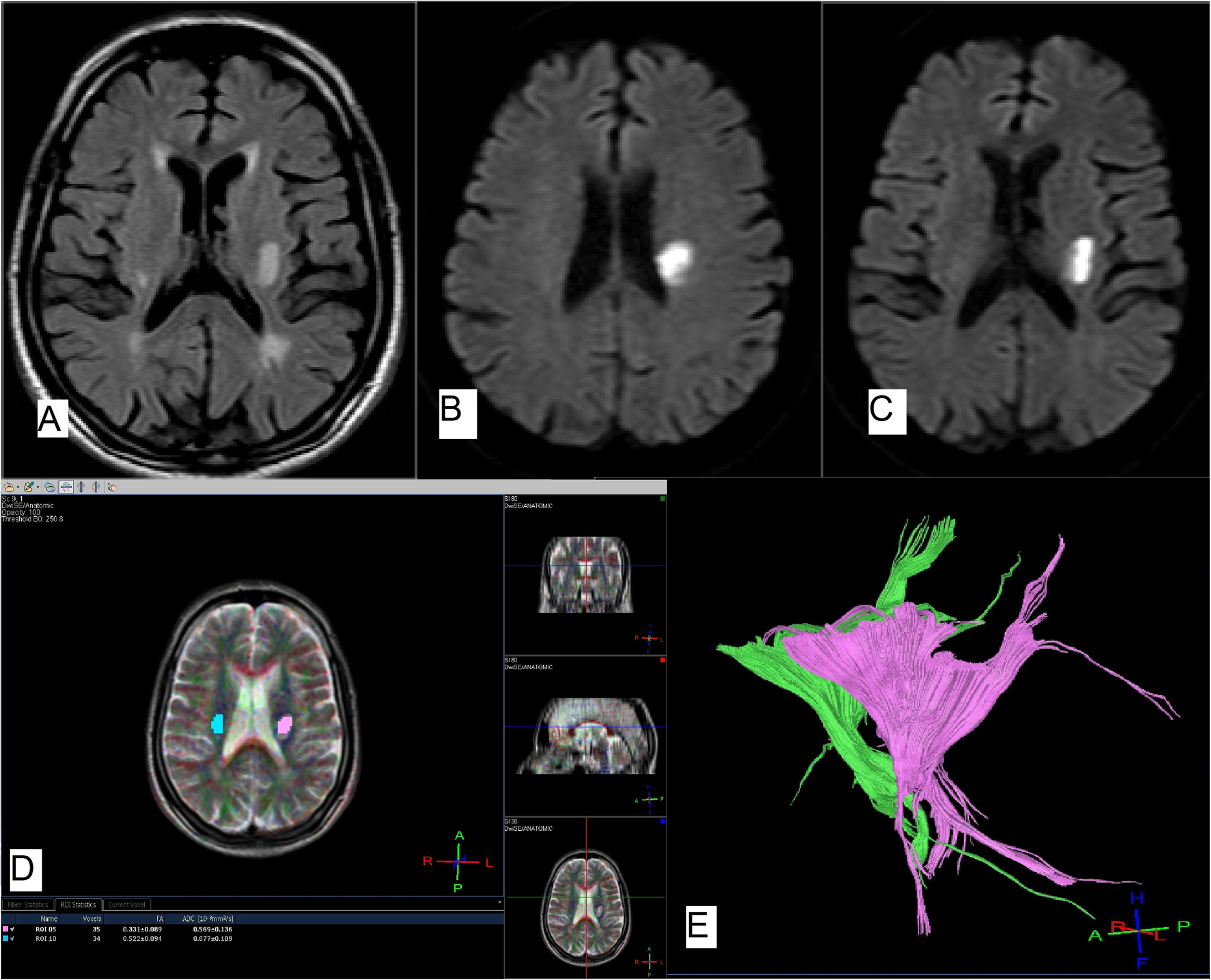 Fig. 2