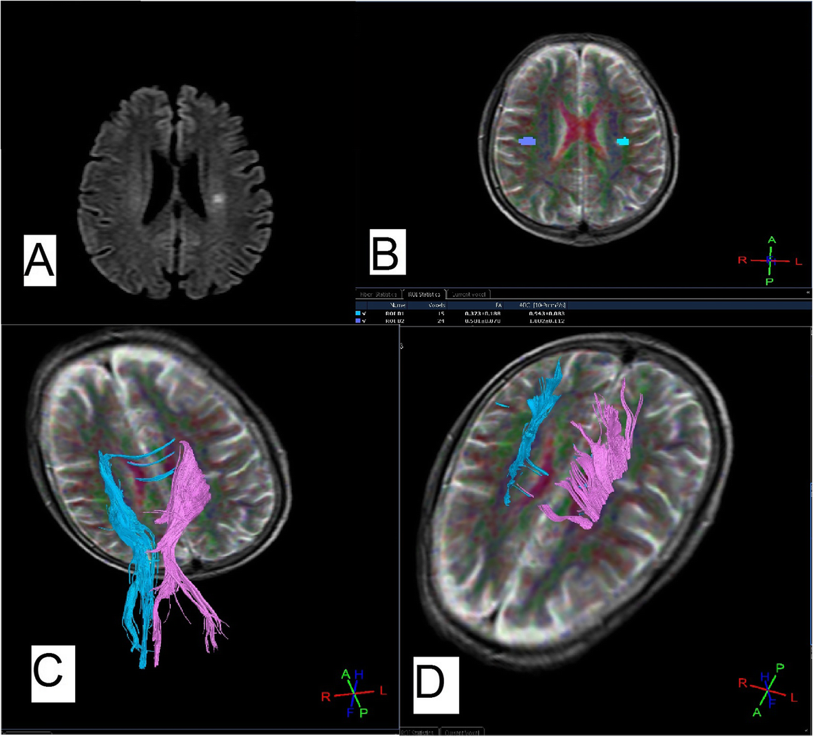 Fig. 4