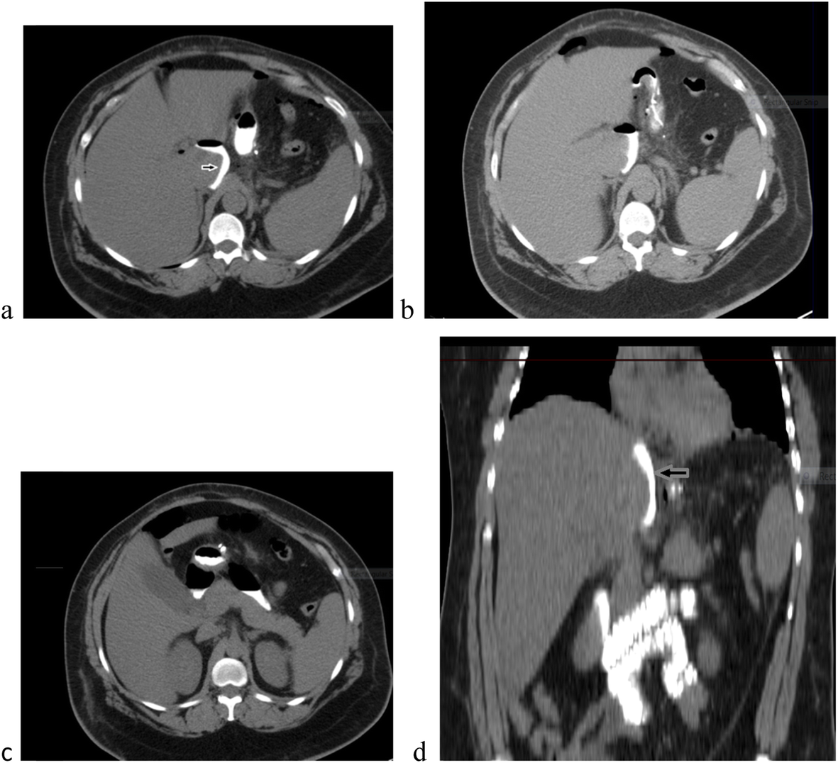 Fig. 10