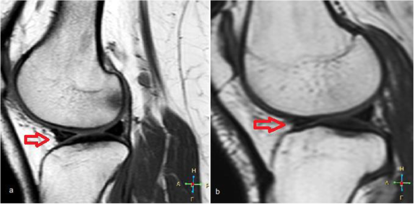 Fig. 11