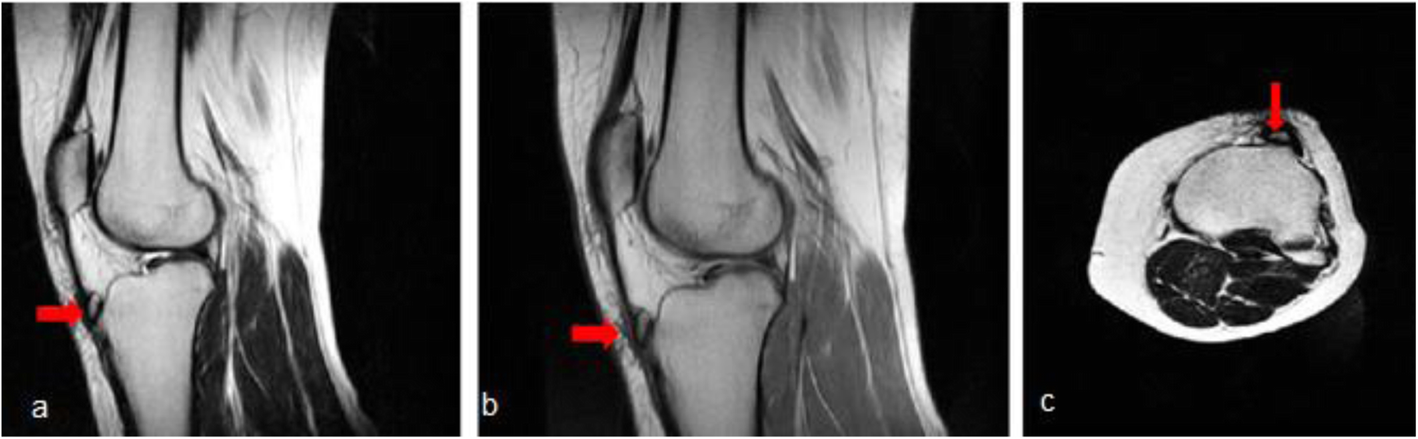 Fig. 13