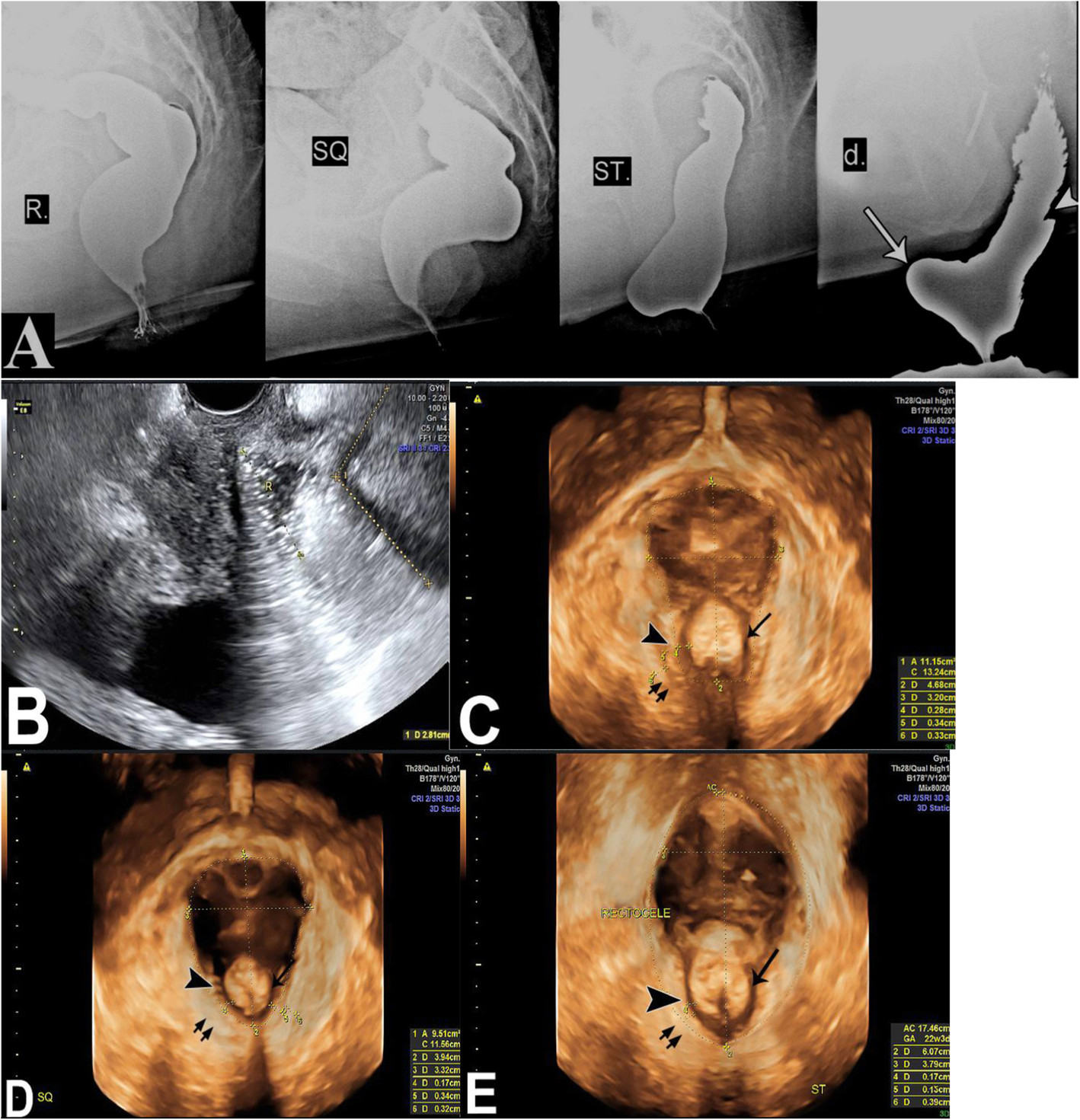 Fig. 3