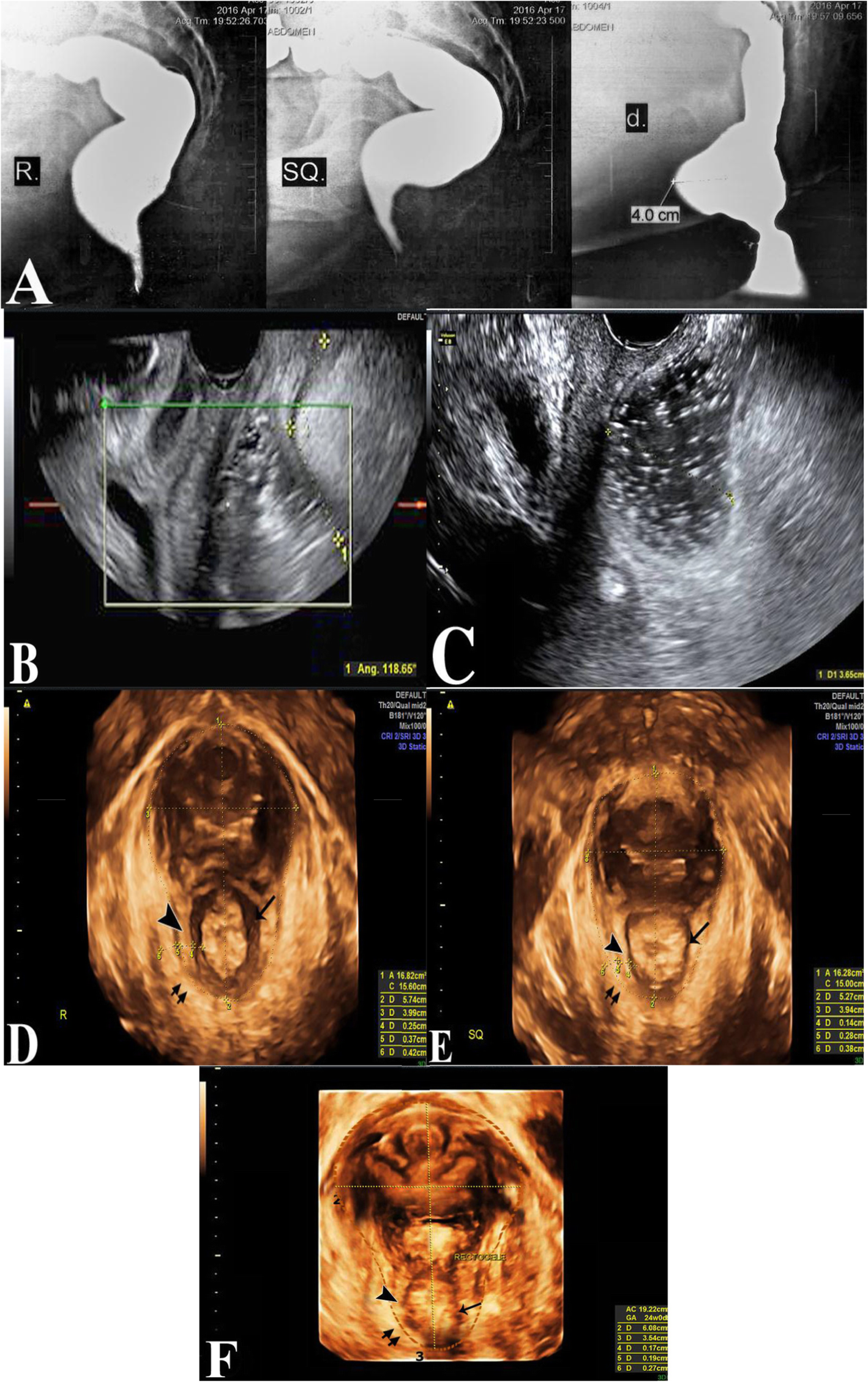 Fig. 4