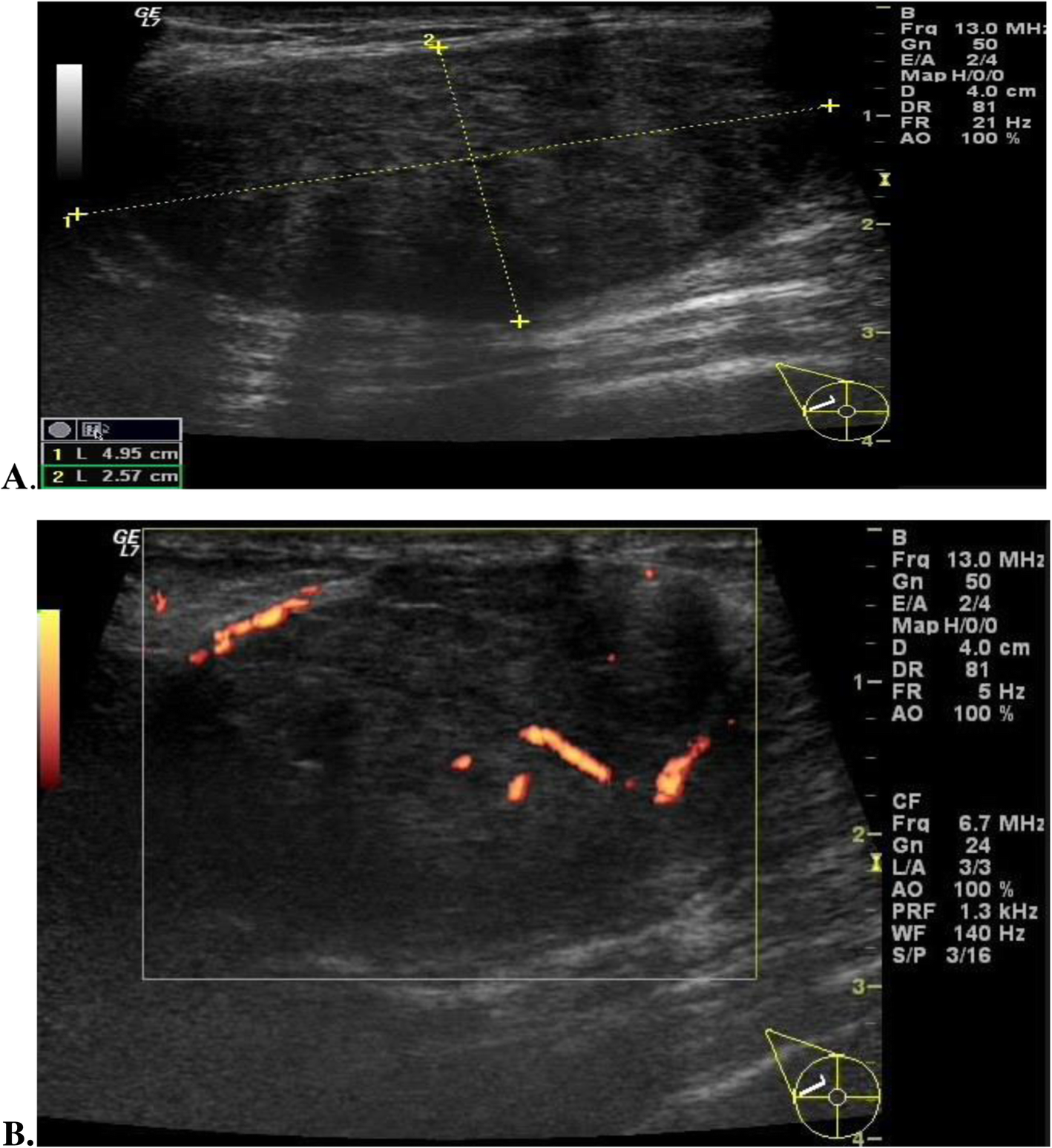 Fig. 14