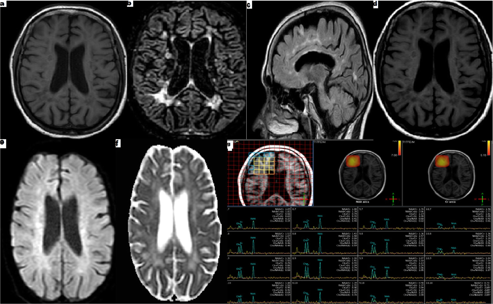 Fig. 2