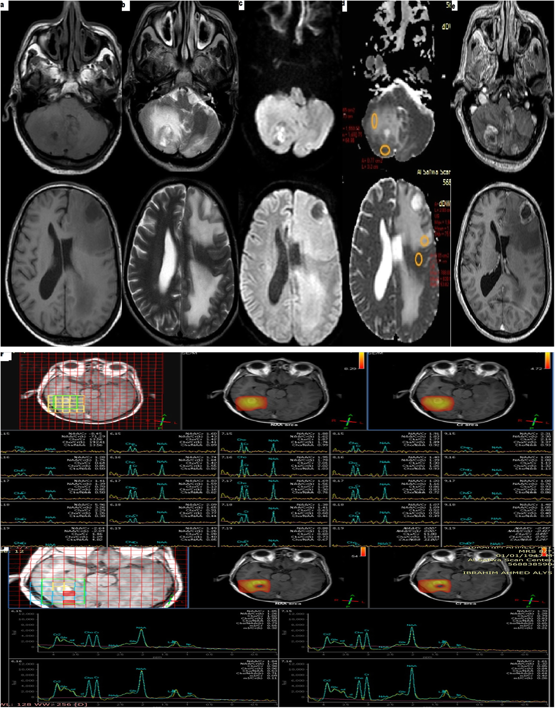 Fig. 3