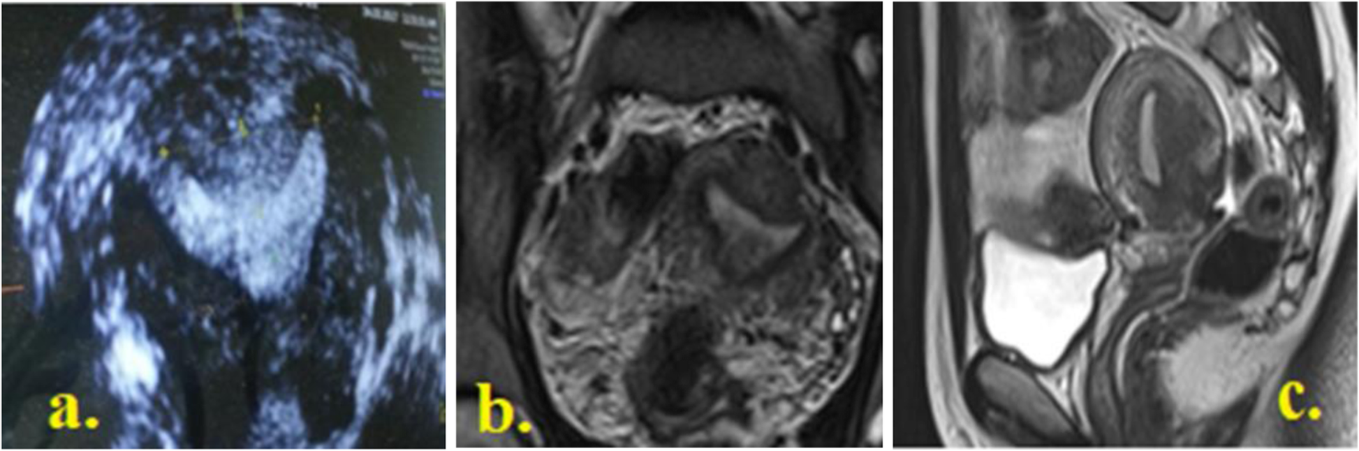 Fig. 5