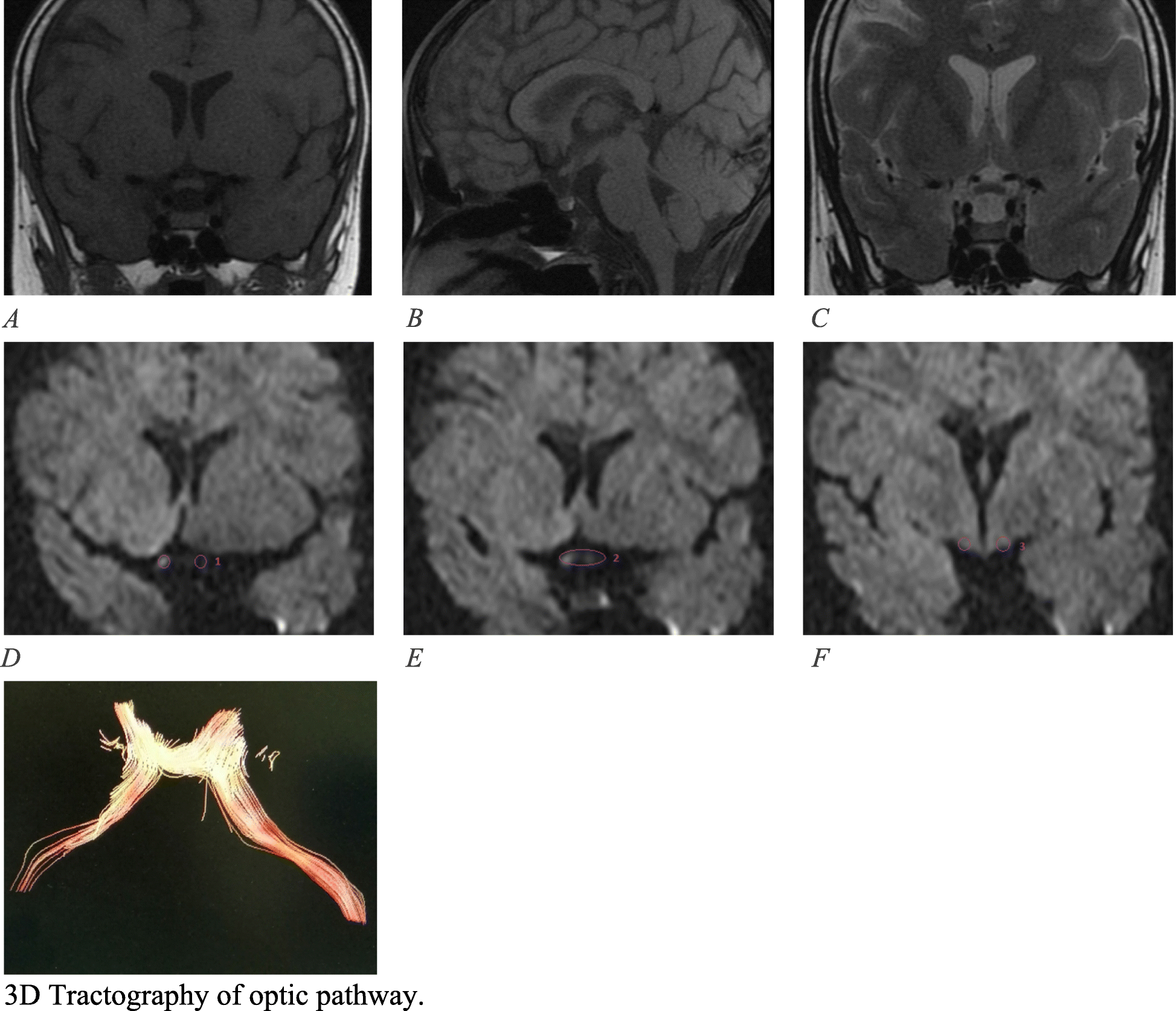 Fig. 4