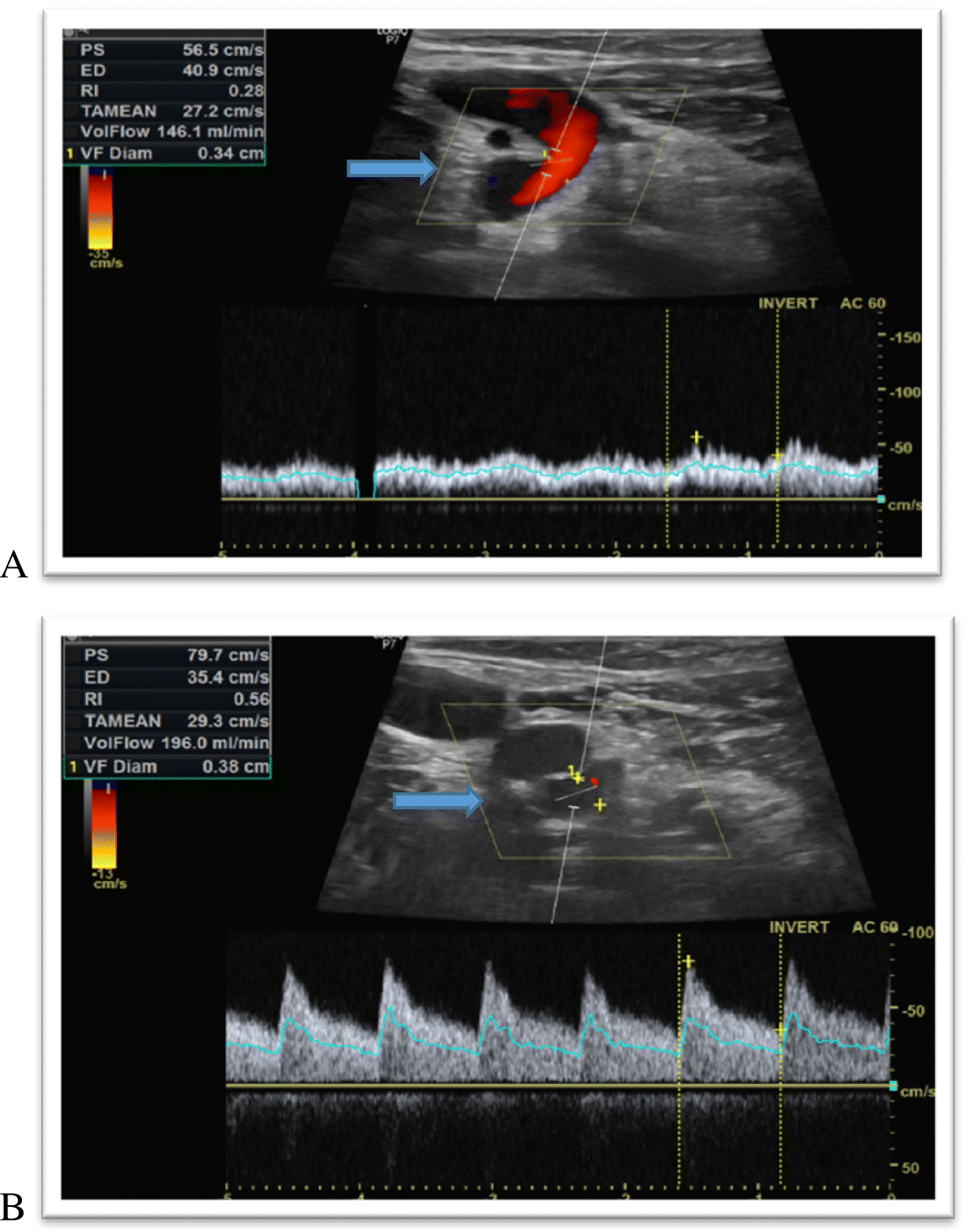 Fig. 4