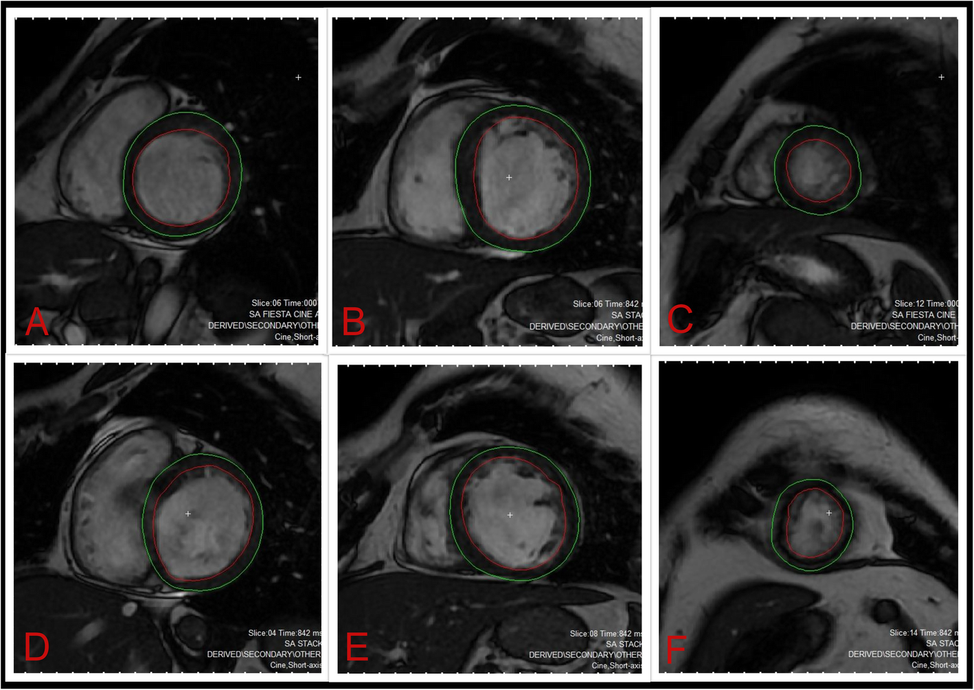 Fig. 9