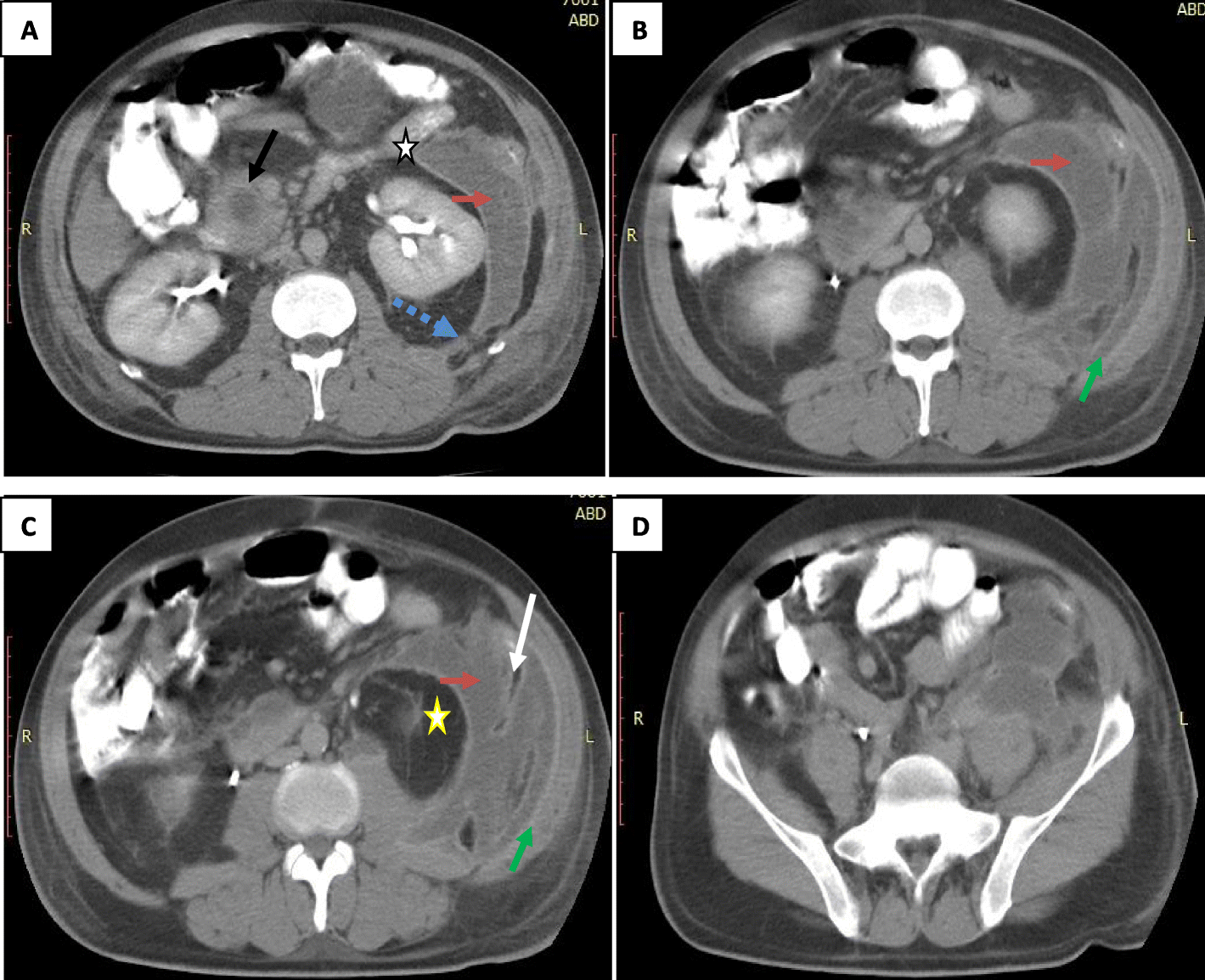 Fig. 4