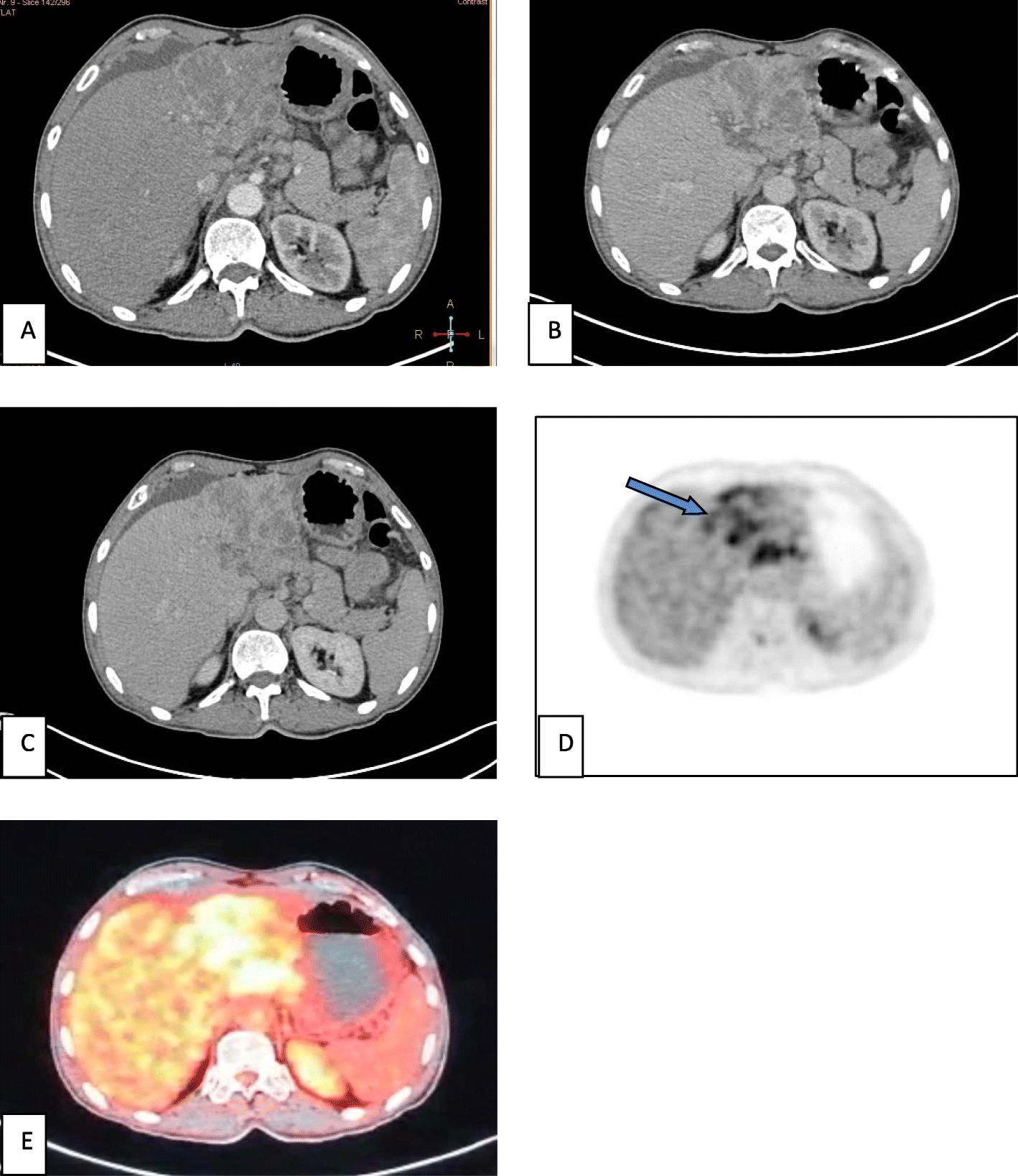 Fig. 3