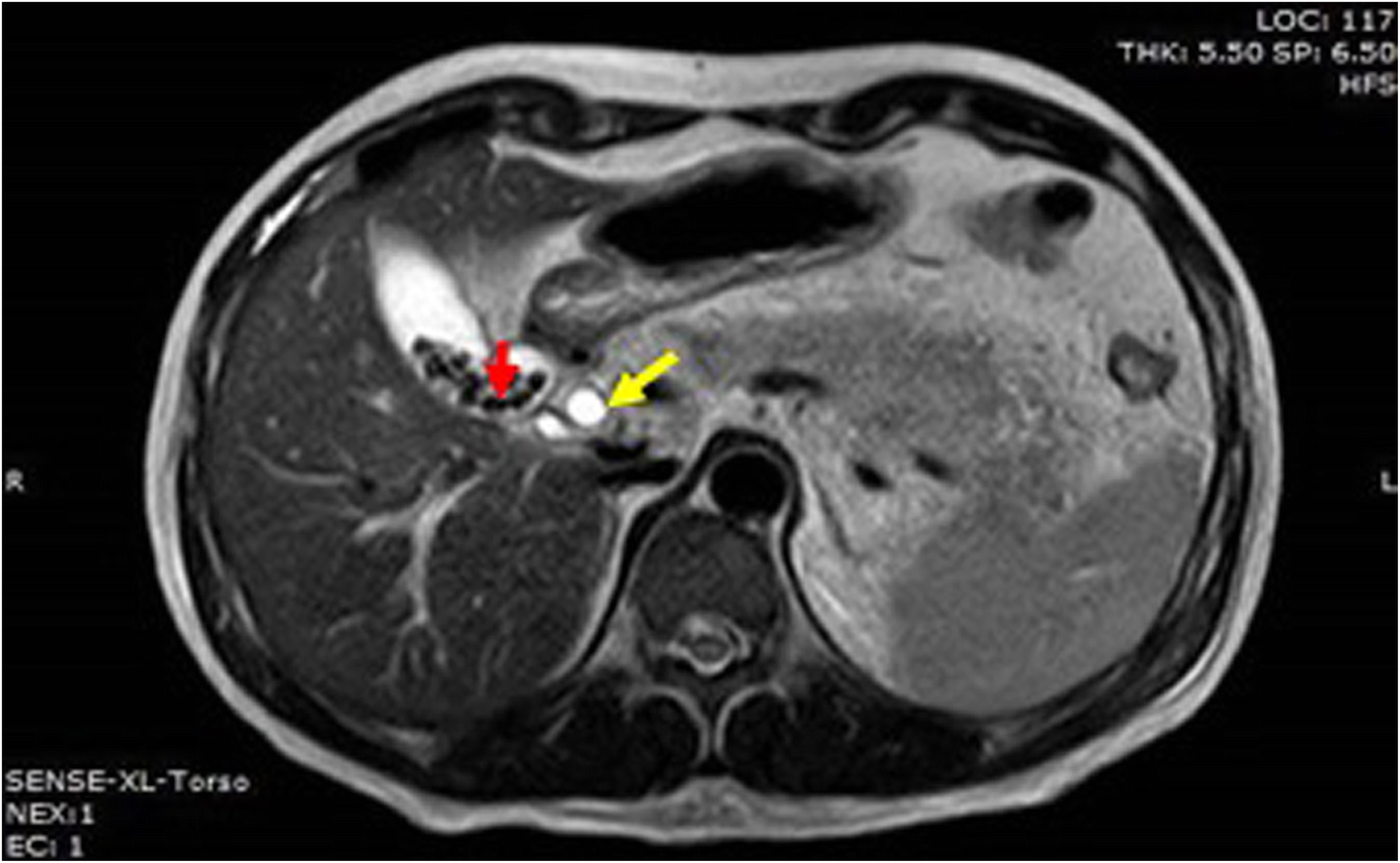 Fig. 4