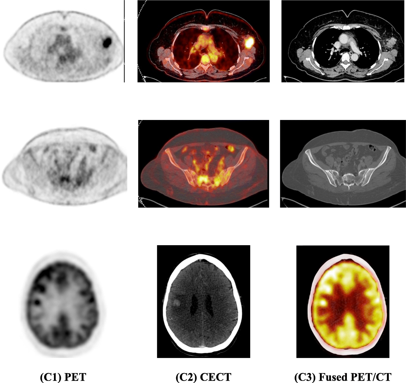 Fig. 1