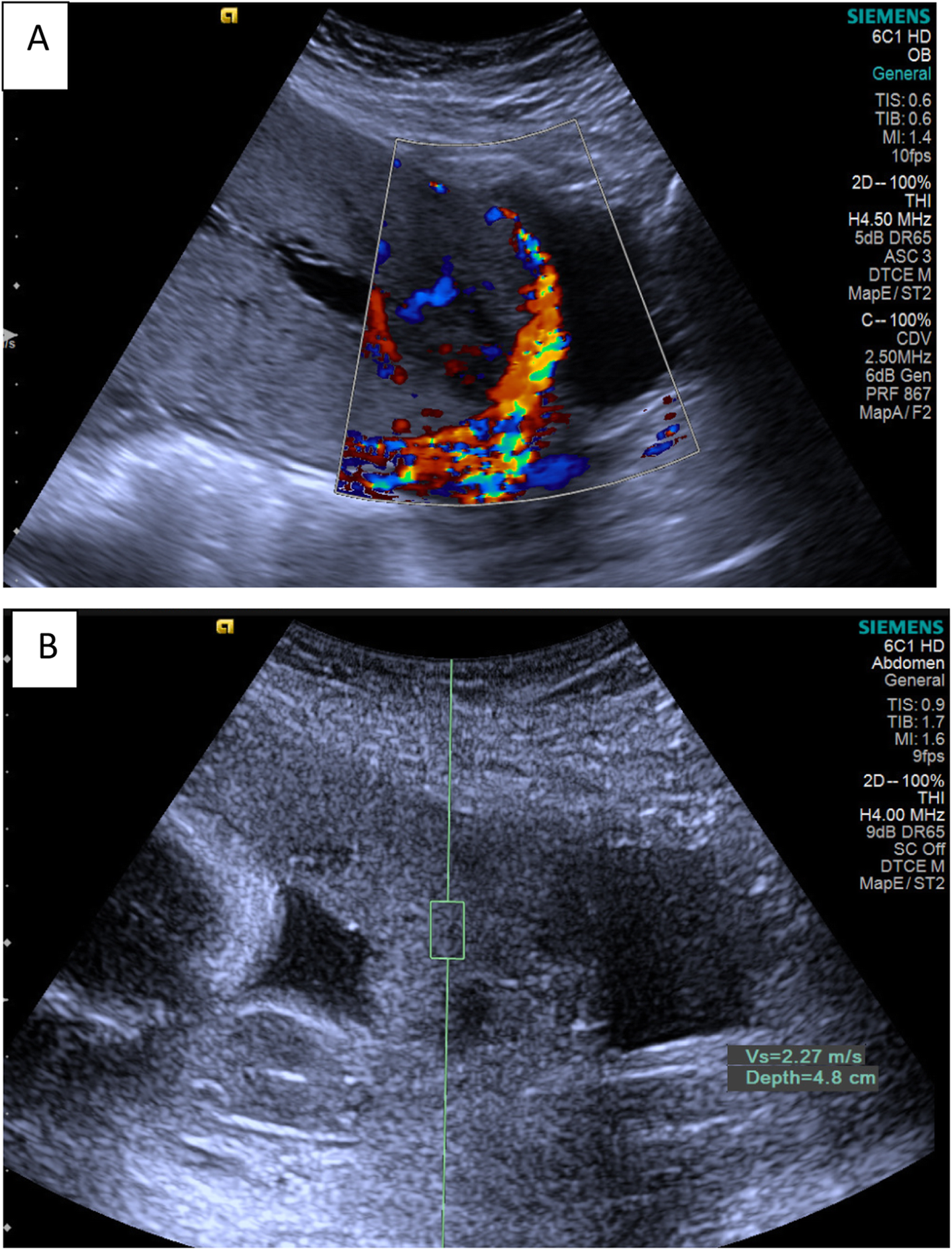 Fig. 5