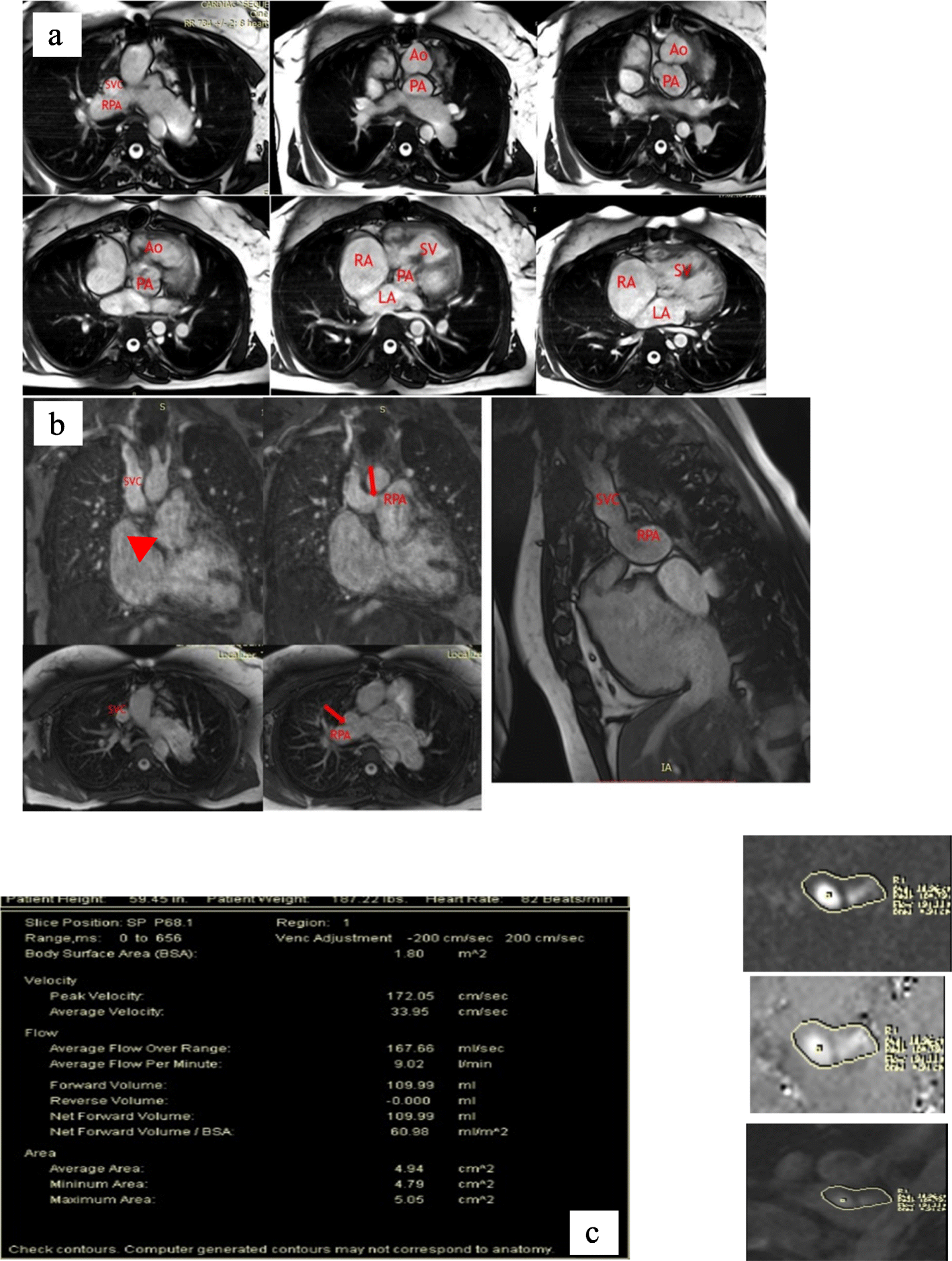 Fig. 4