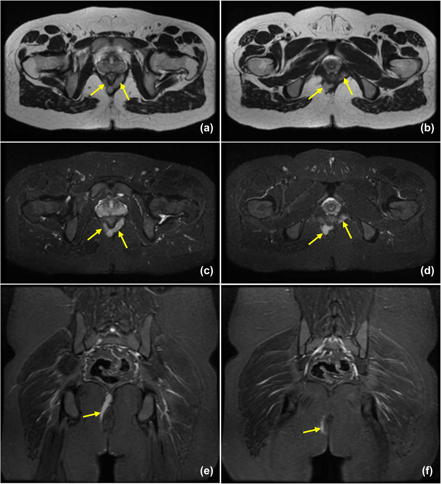 Fig. 14