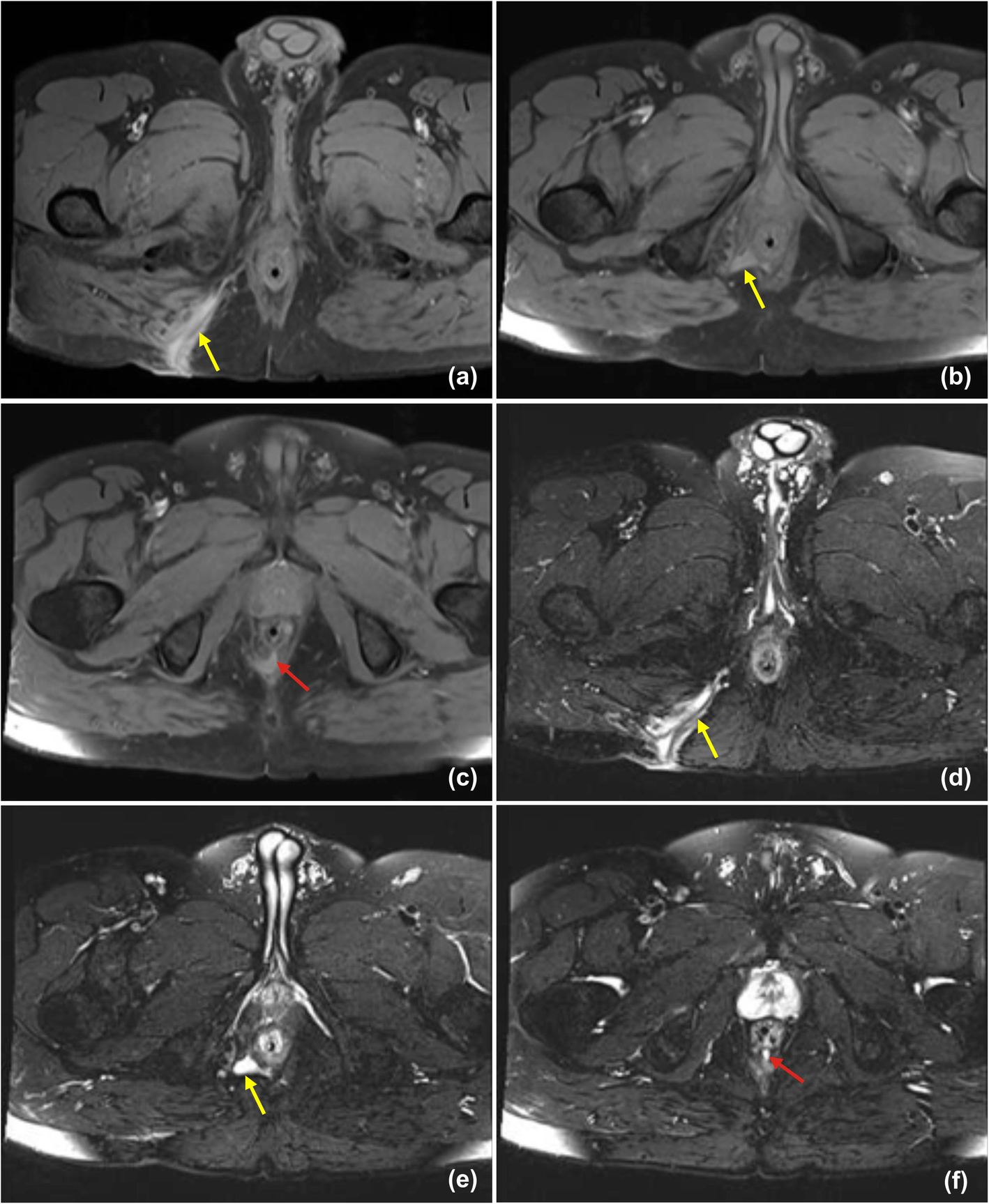 Fig. 15