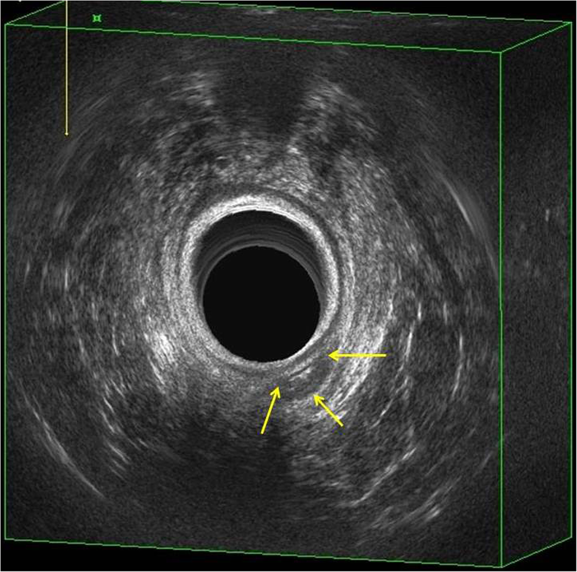 Fig. 9