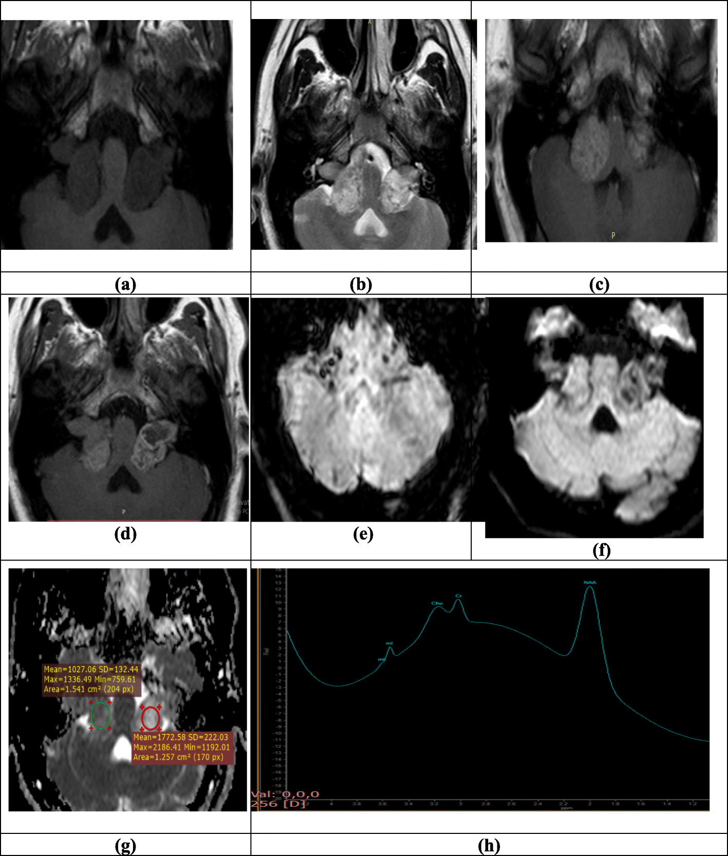 Fig. 3